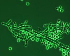 GLBRC-yeast