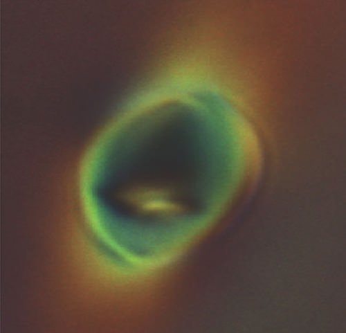 vesicle deformation