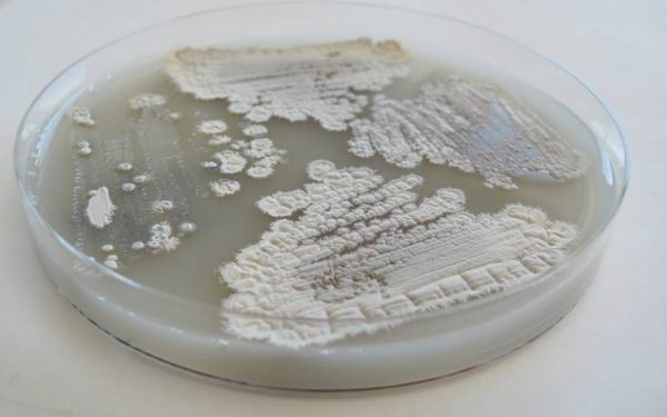 celluloseStreptomyces