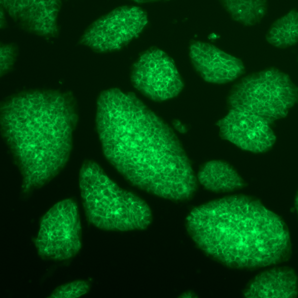 ATF_iPS_cells