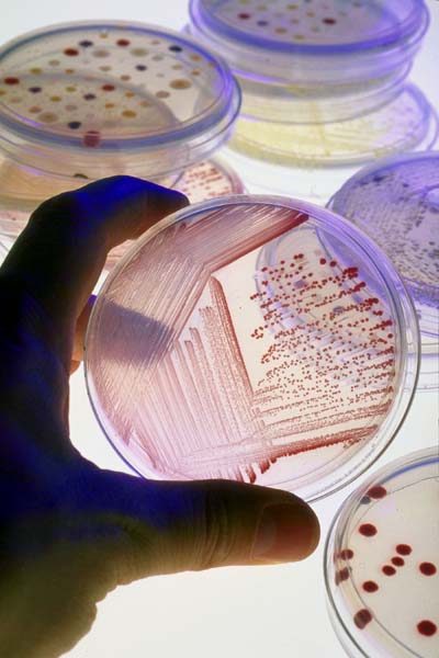 Petri dish cultures of soil bacteria for Plant Pathology research